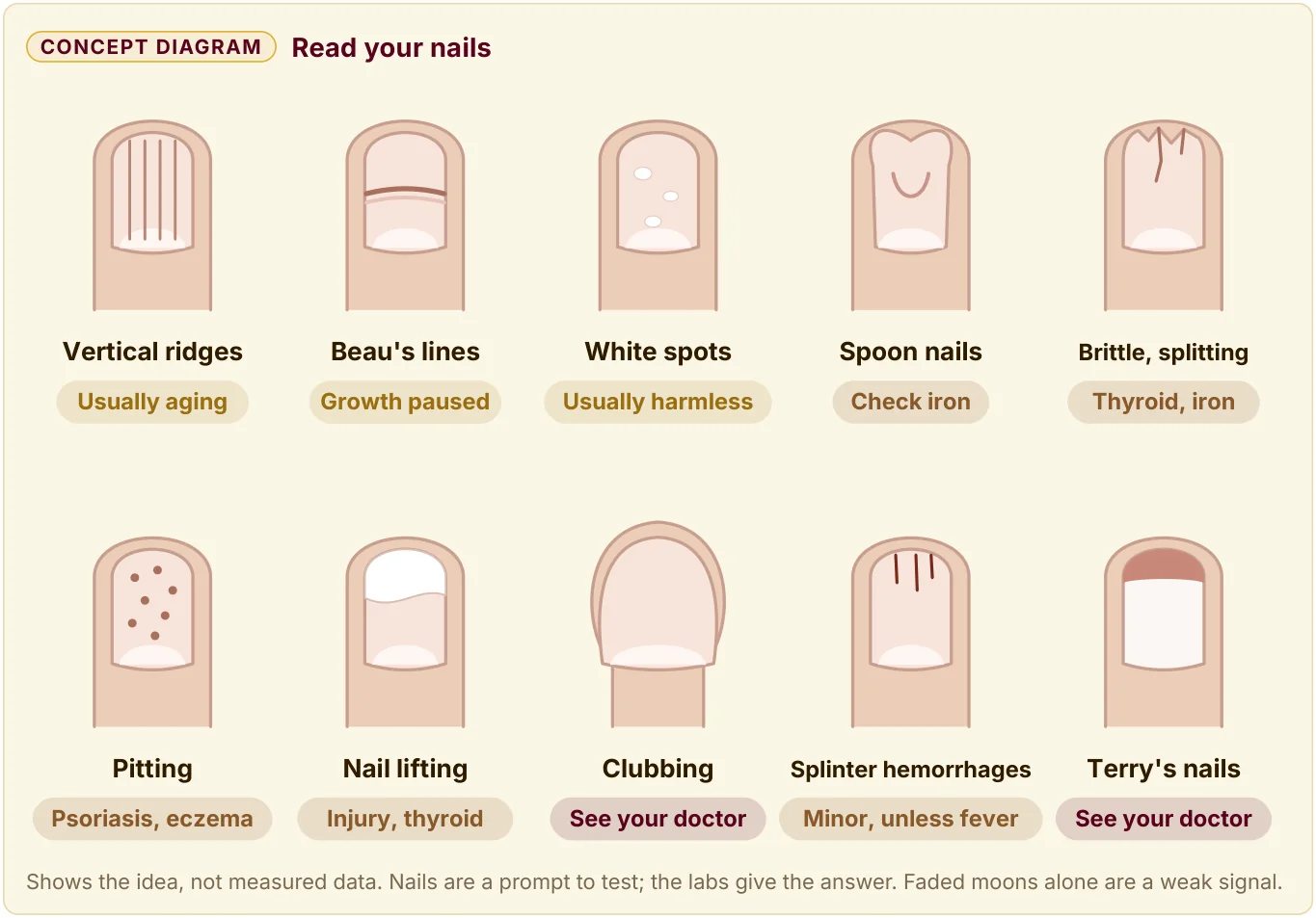 Guide to what ridges, spots, spoon shape, pitting, and clubbing in your nails can point to, and when to see a doctor.